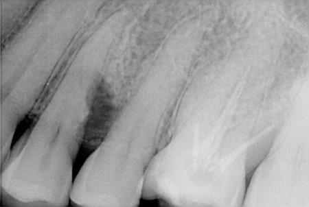 レントゲン検査