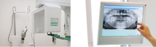 デジタルパノラマX線装置 デジタルパノラマX線装置