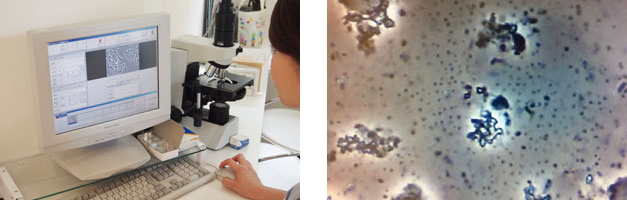 位相差顕微鏡 位相差顕微鏡