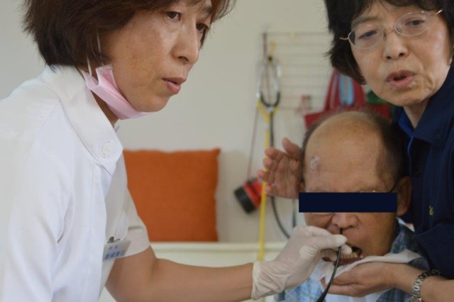 鼻咽腔ファイバースコープ