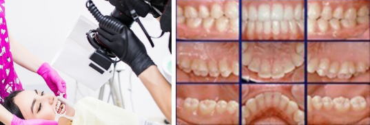 レントゲン写真や口腔内写真の撮影