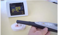 むし歯発見器(ダイアグノデント) むし歯発見器(ダイアグノデント)