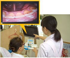 口腔内カメラ(サパナ) 口腔内カメラ(サパナ)